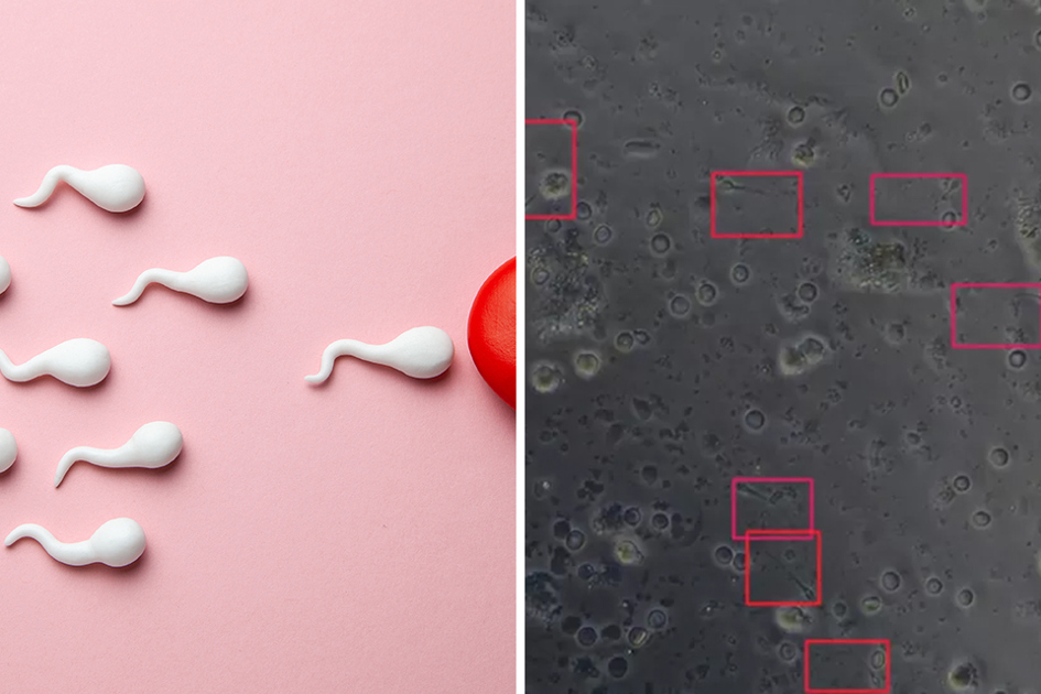 Tecknade Spermier Simmar Mot Ett Ägg; Bilder Från Sperm Search; Forskning, Ai Copy
